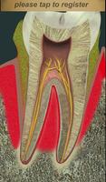 Dental Pain Lite