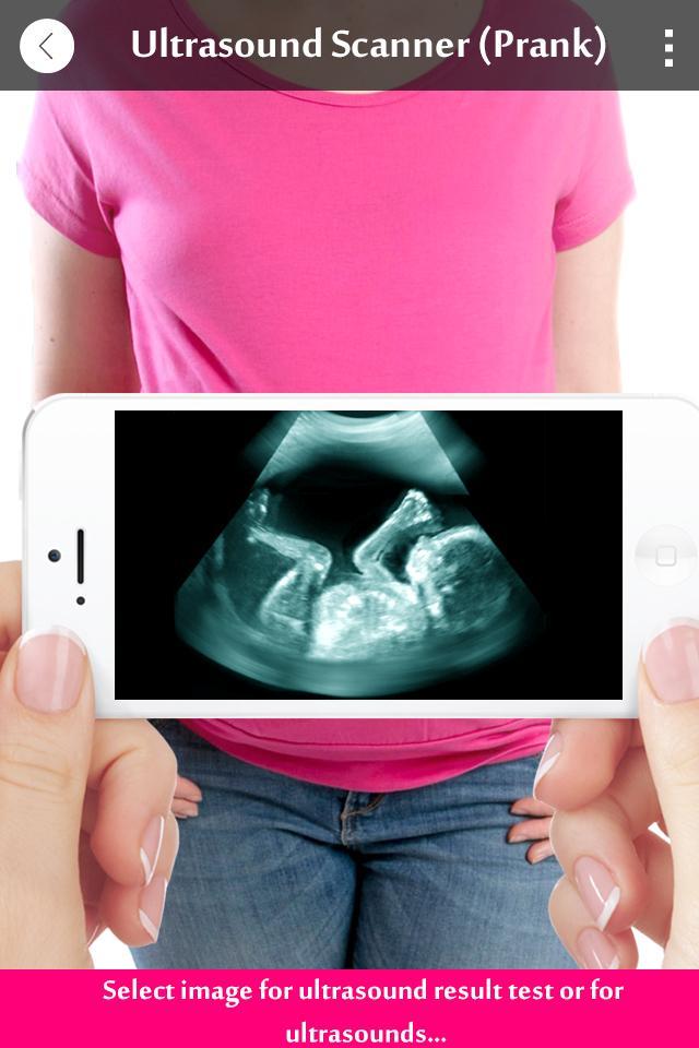 Ultrasound X-ray Scanner Prank